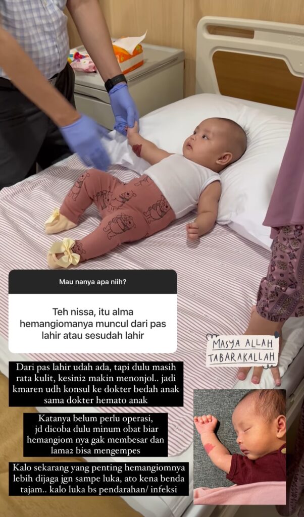 Ini yang Dilakukan Anisa Rahma Saat Mengetahui Anaknya Memiliki Hemangioma