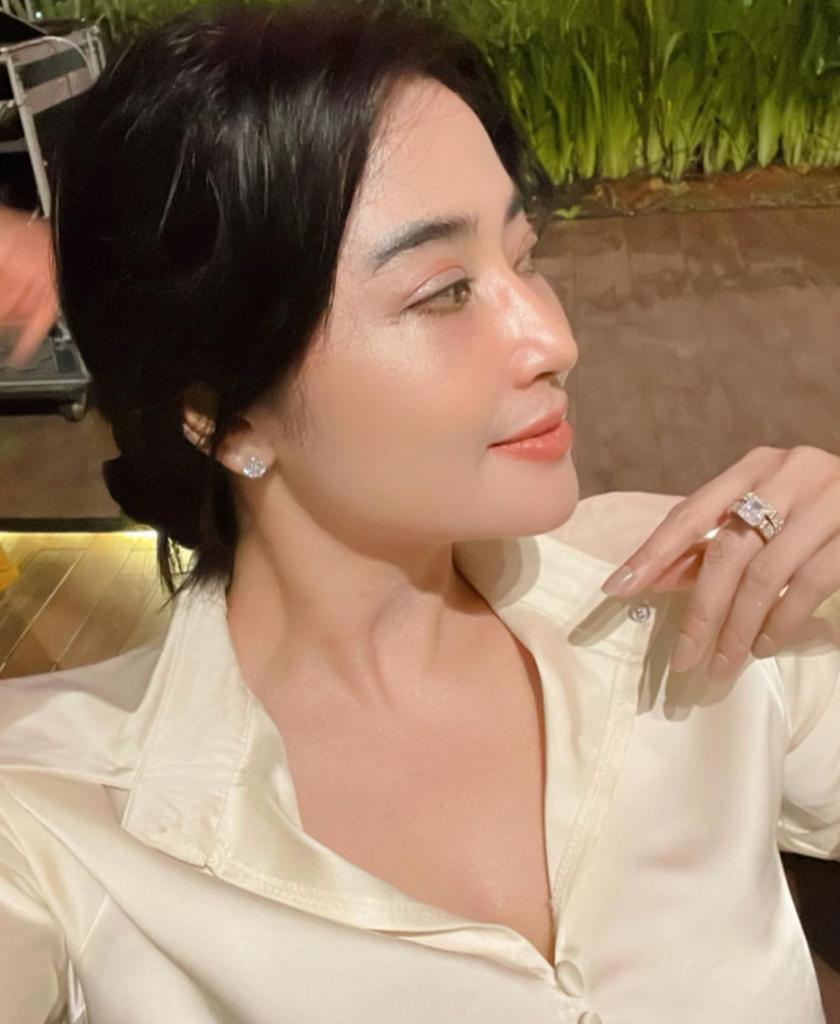 Heboh Dewi Perssik Oplas Muka, Cek Faktanya!